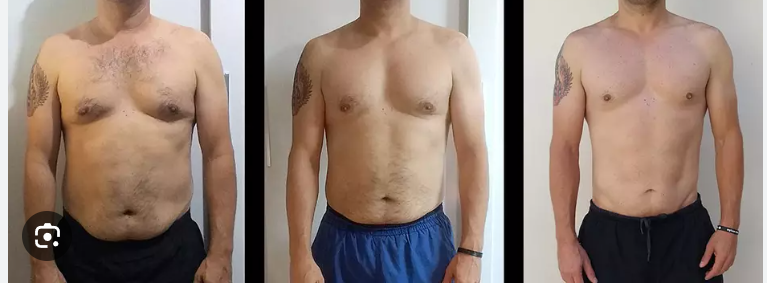 Before/After