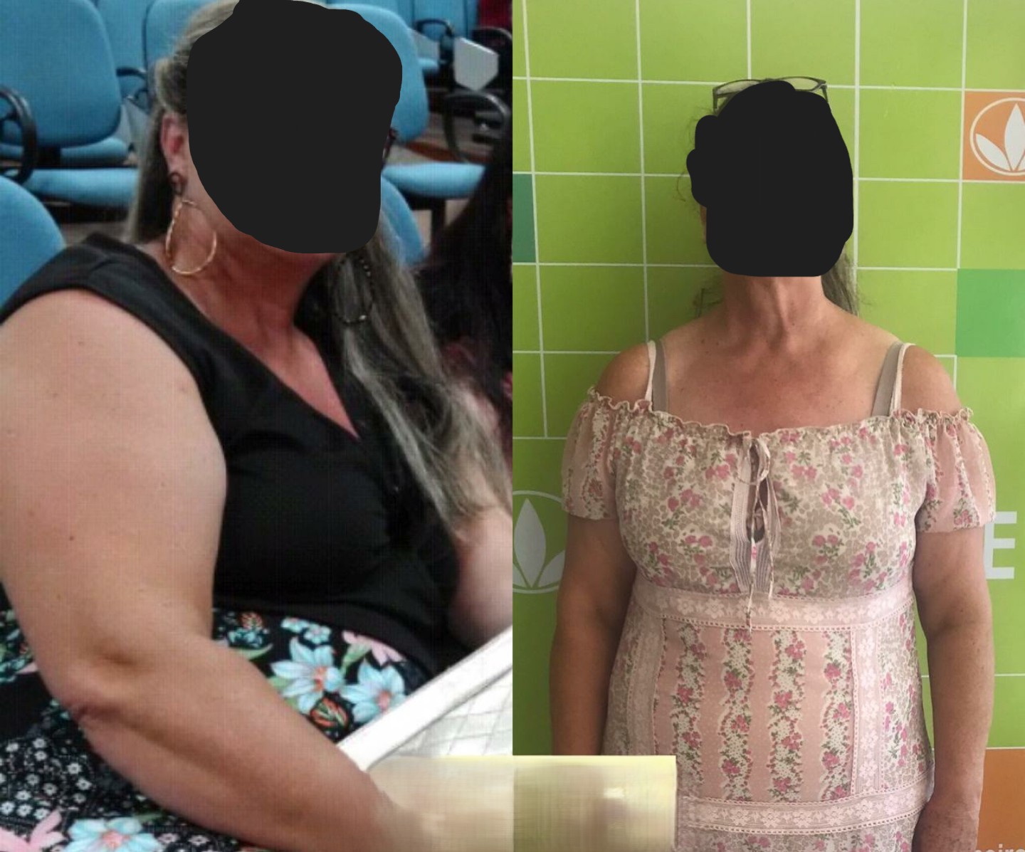 Before/After