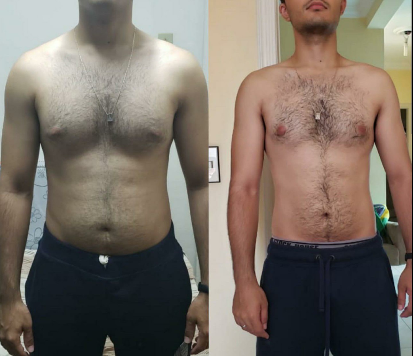 Before/After