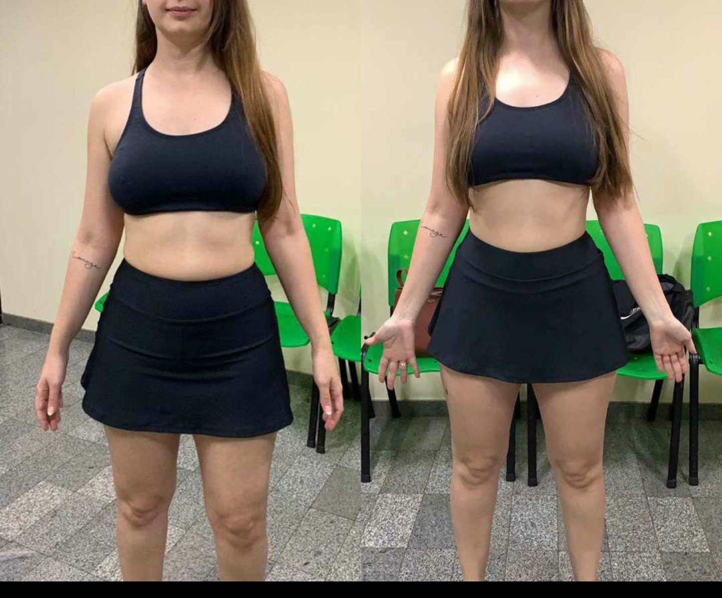 Before/After