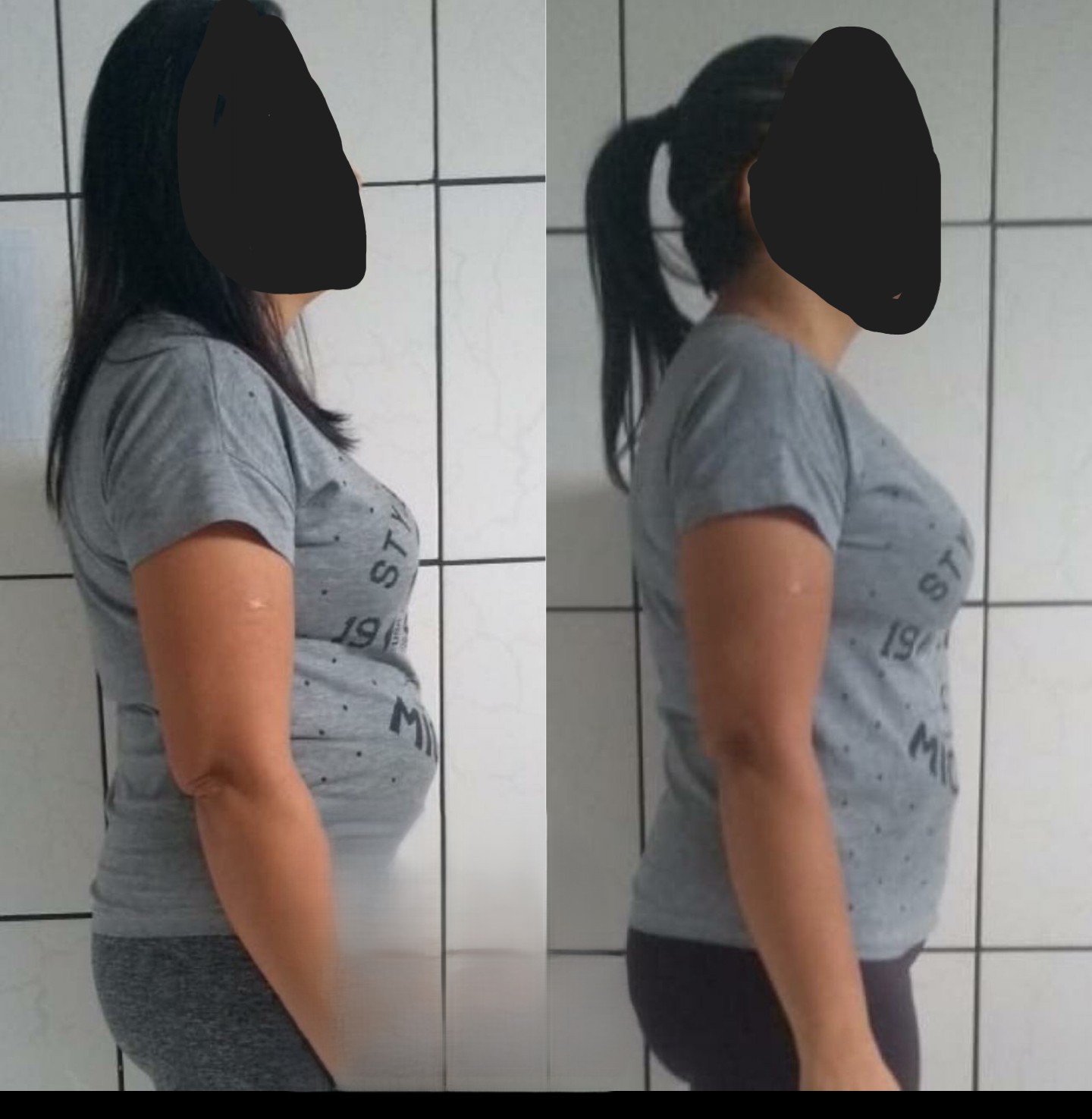Before/After