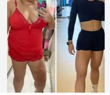 Before/After
