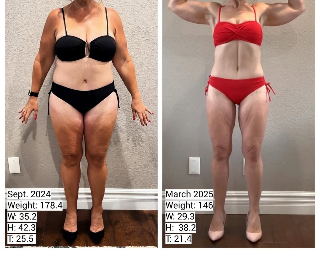 Before/After