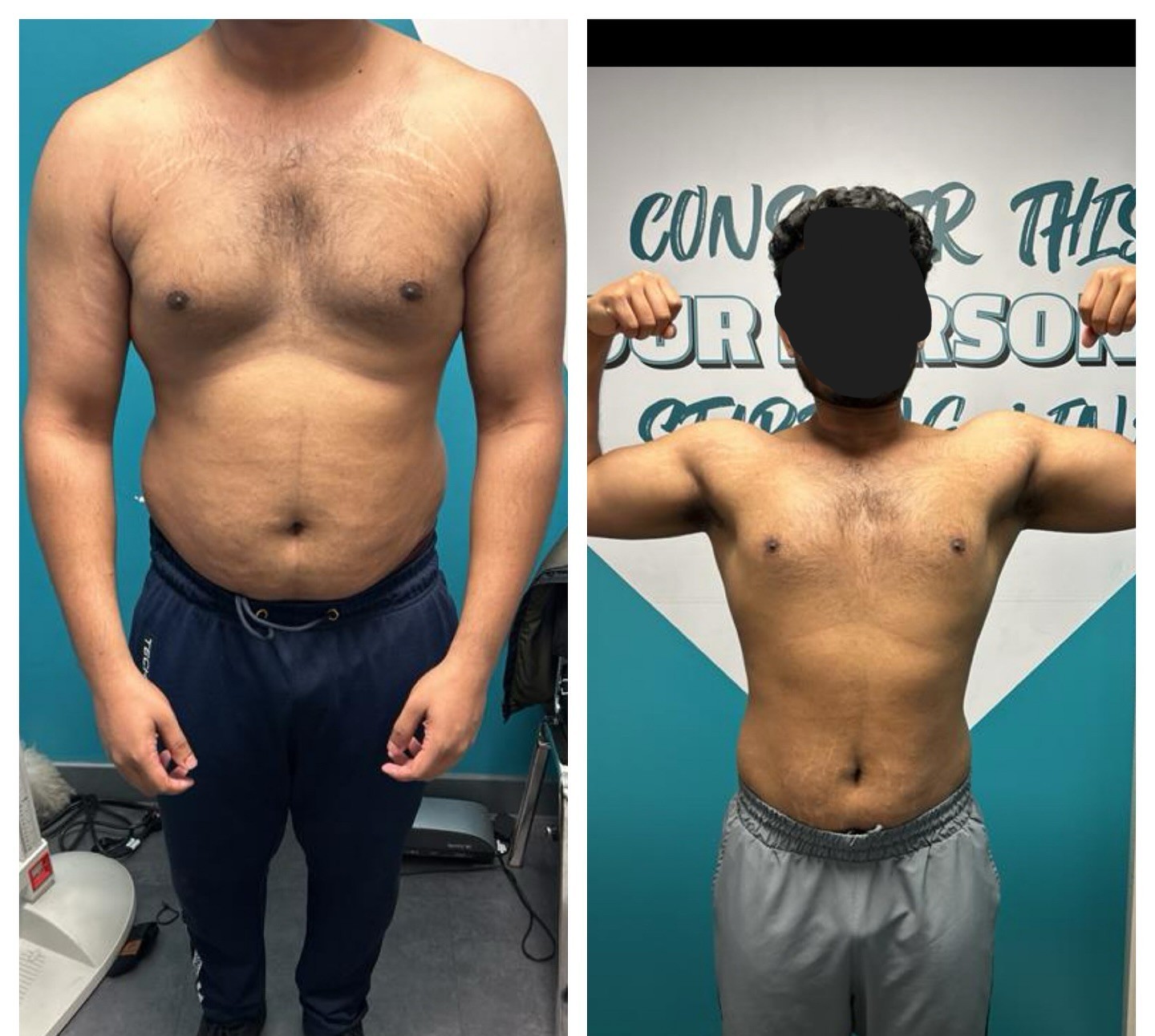 Before/After