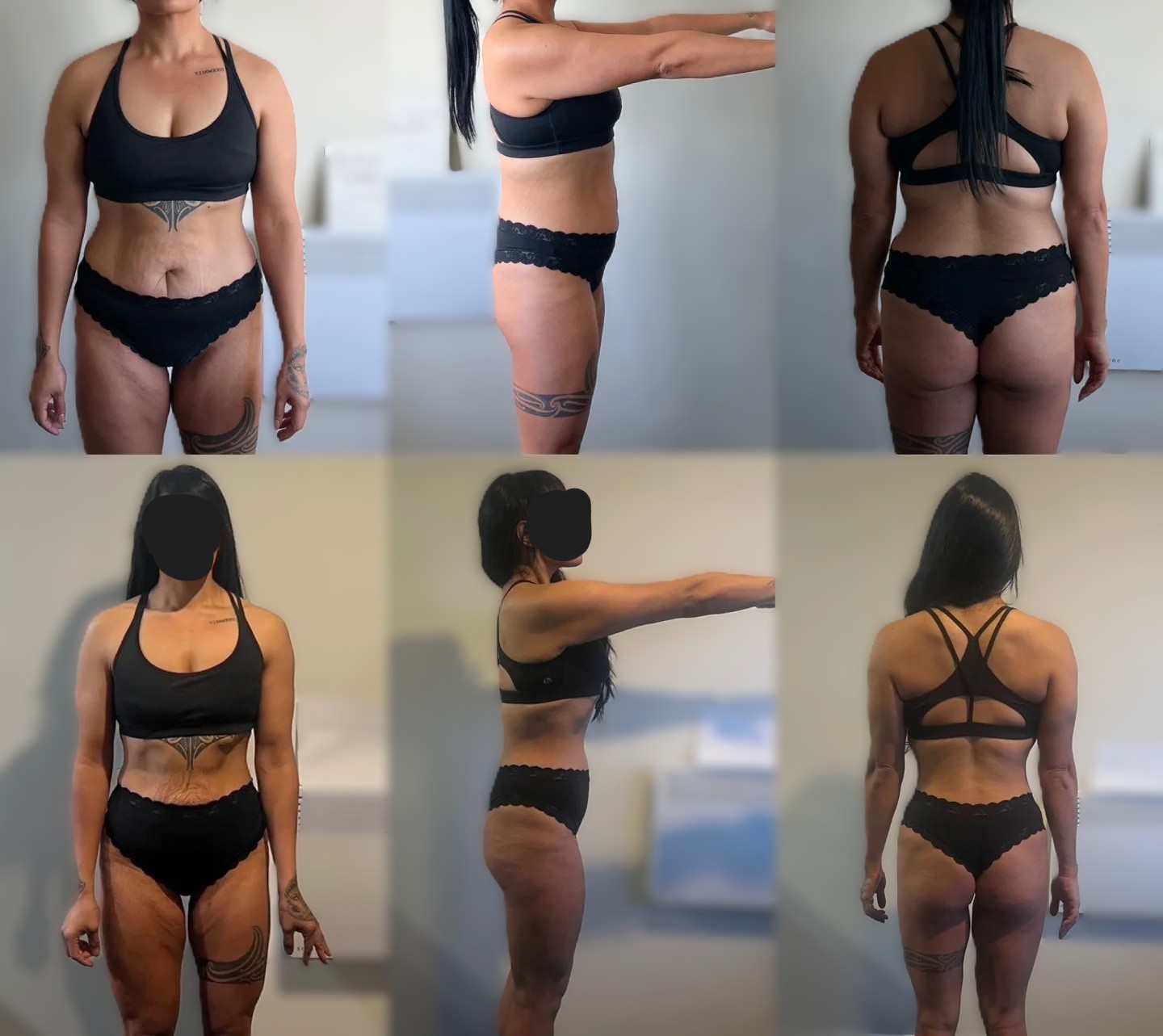 Before/After