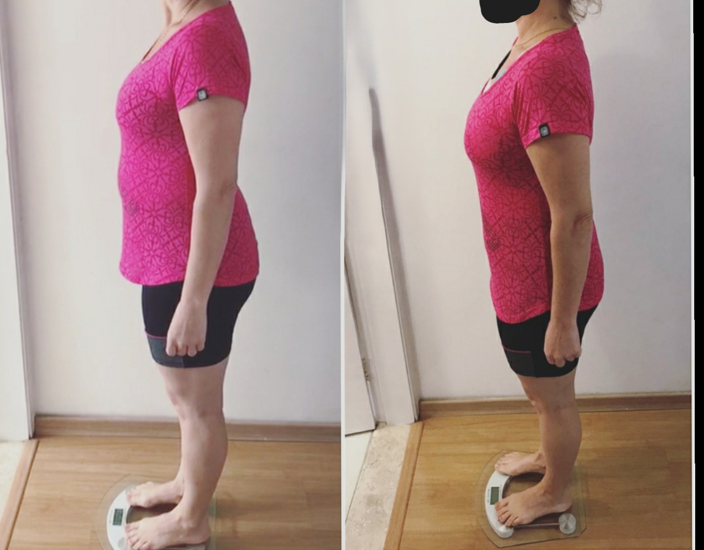 Before/After